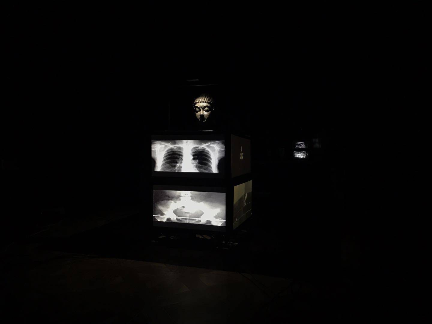 soul segmentation 丨 灵魂切割