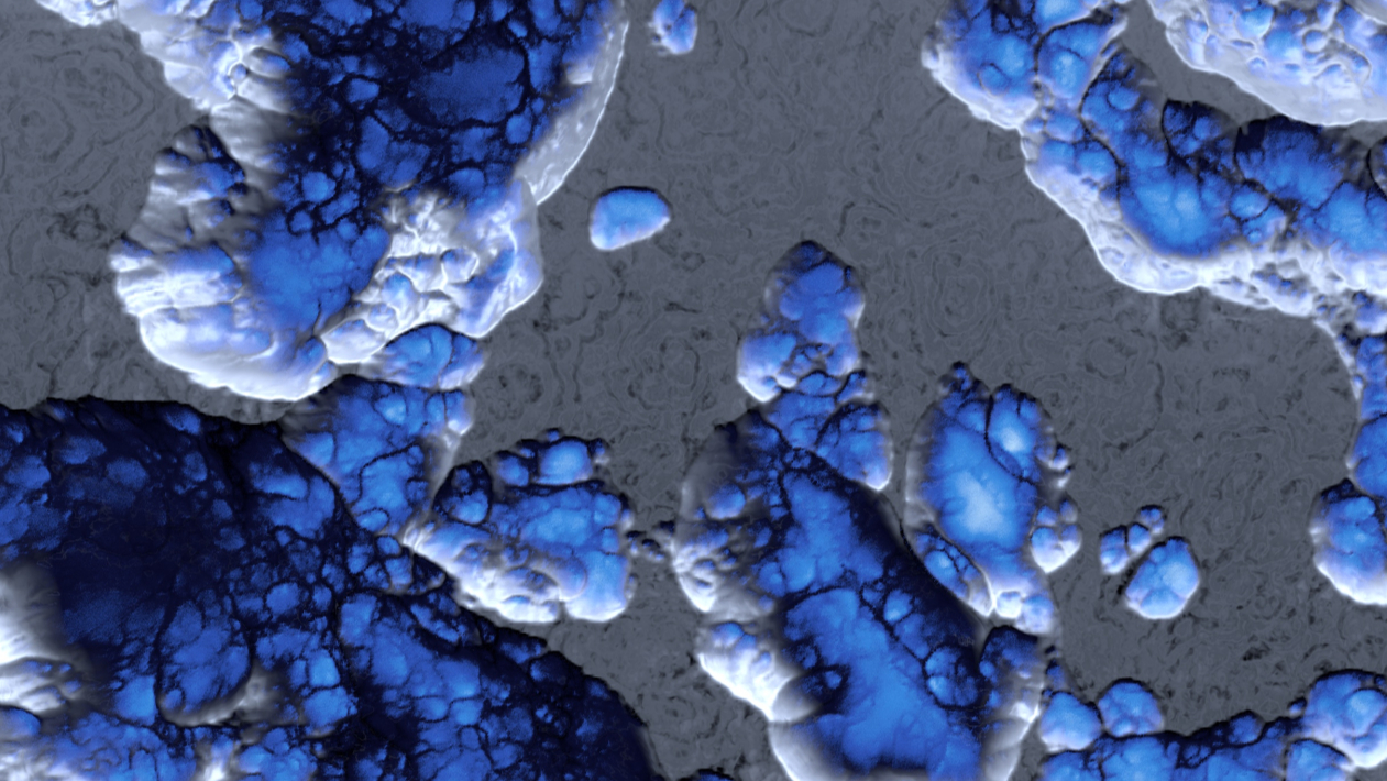 Surface