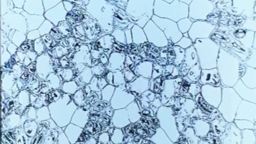 Amnesia失忆症